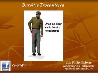 Bursitis Trocantereana