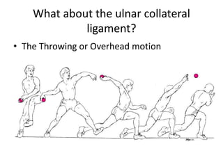 What about the ulnar collateral
ligament?
• The Throwing or Overhead motion
 