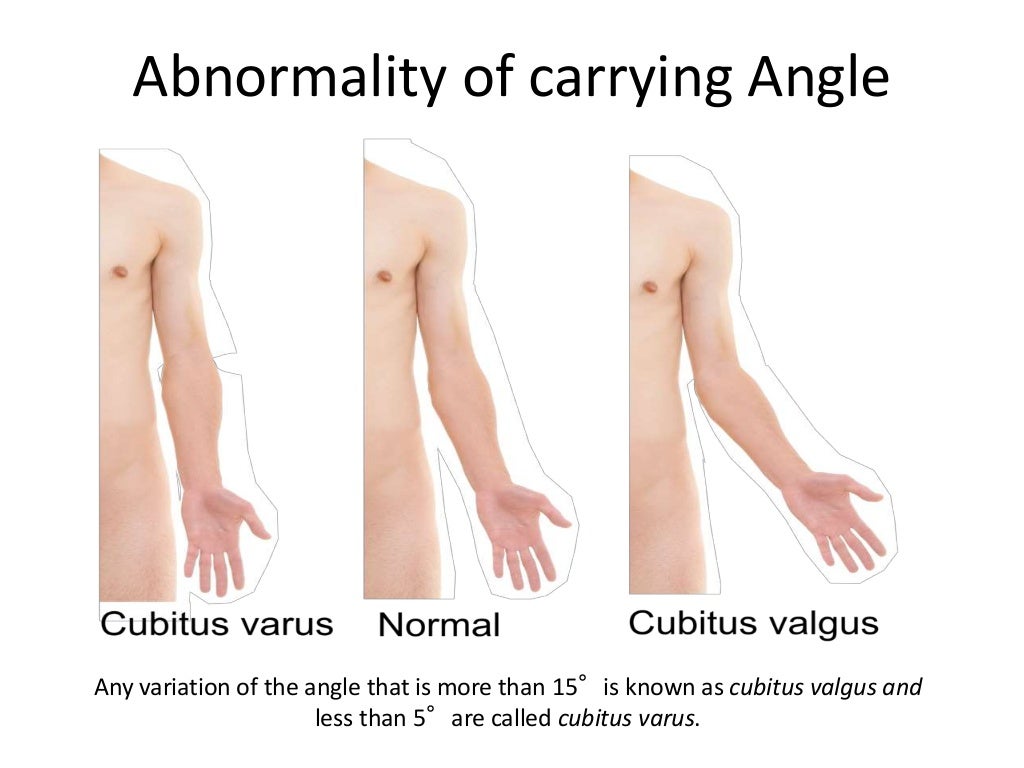 Carrying Angle