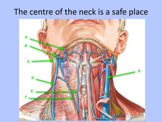 The centre of the neck is a safe place

 