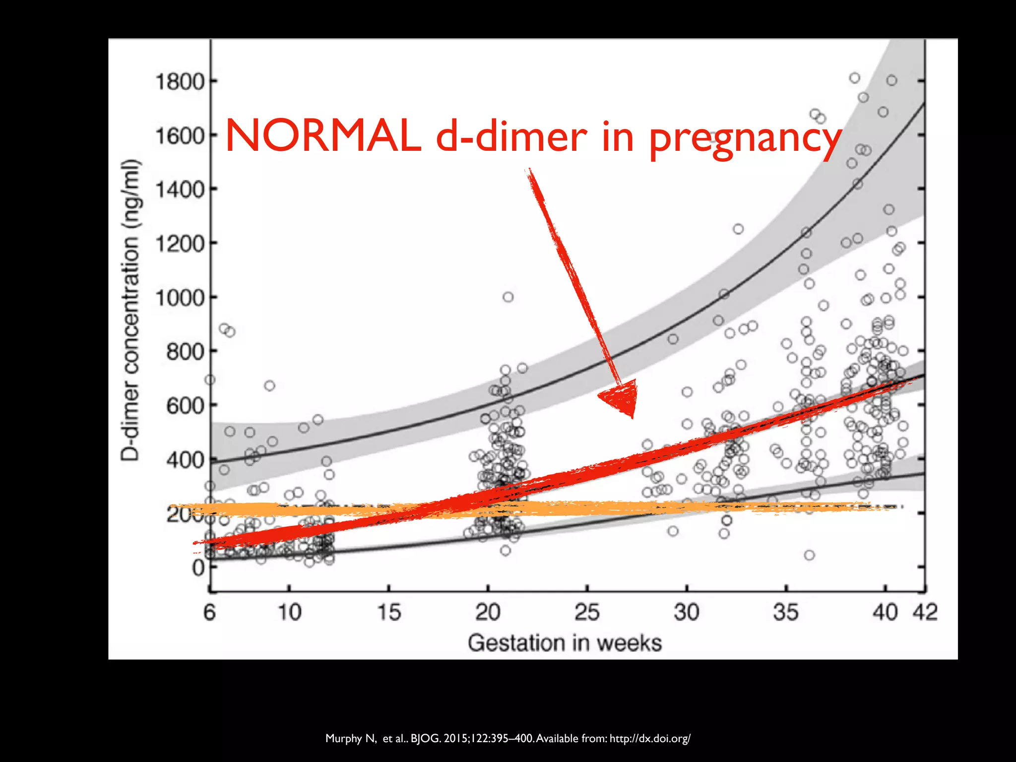 Murphy N, et al.. BJOG. 2015;122:395–400.Available from: http://dx.doi.org/
NORMAL d-dimer in pregnancy
 