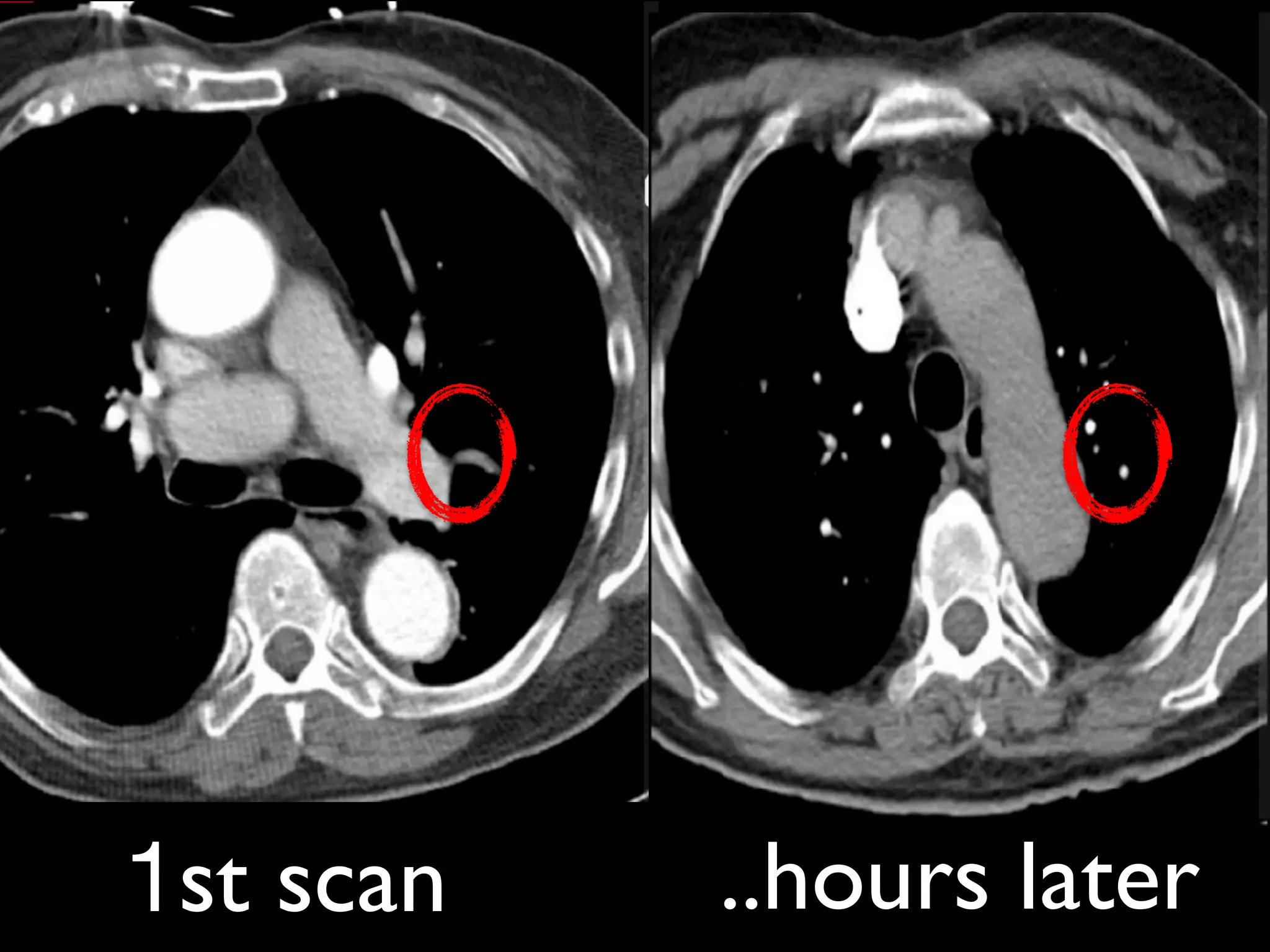 ..hours later1st scan
 