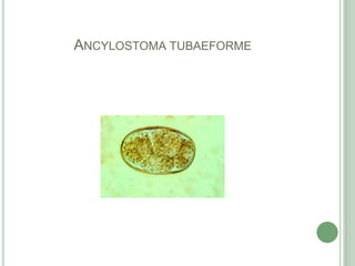 Ancylostomatubaeforme