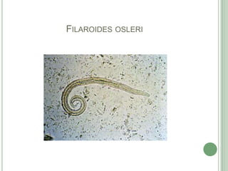 Filaroidesosleri