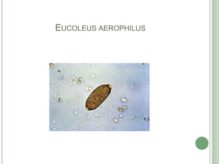 Eucoleusaerophilus