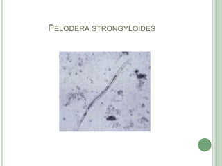 Peloderastrongyloides