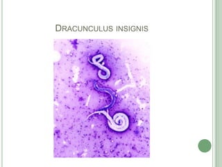 Dracunculusinsignis