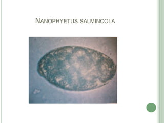 Nanophyetussalmincola