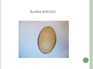 Alaria species