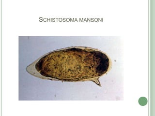 Schistosomamansoni