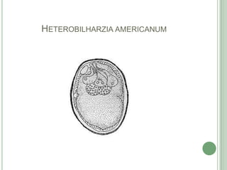 Heterobilharziaamericanum