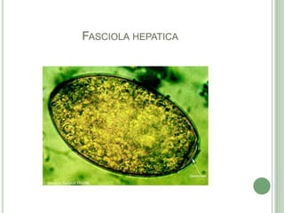 Fasciola hepatica
