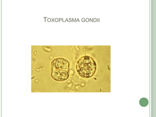 Toxoplasmagondii