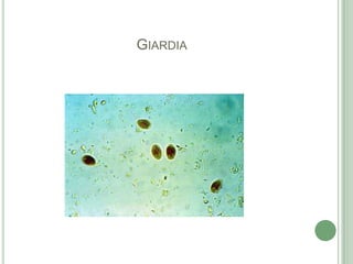 Giardia