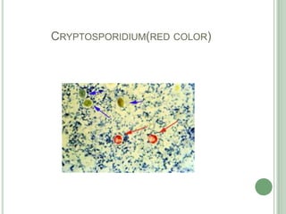 Cryptosporidium(red color)