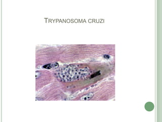 Trypanosomacruzi