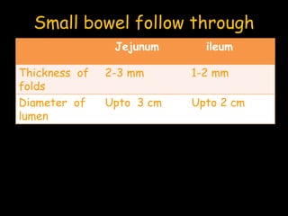 Small bowel follow through
Jejunum ileum
Thickness of
folds
2-3 mm 1-2 mm
Diameter of
lumen
Upto 3 cm Upto 2 cm
 