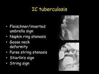 IC tuberculosis
• Fleischner/inverted
umbrella sign
• Napkin ring stenosis
• Goose neck
deformity
• Purse string stenosis
• Stierlin’s sign
• String sign
 
