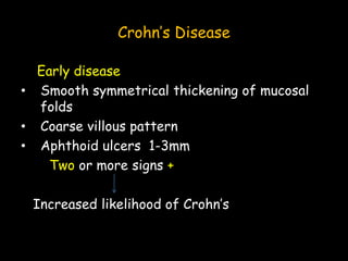 Crohn’s Disease
Early disease
• Smooth symmetrical thickening of mucosal
folds
• Coarse villous pattern
• Aphthoid ulcers 1-3mm
Two or more signs +
Increased likelihood of Crohn’s
 
