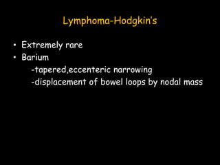 Lymphoma-Hodgkin’s
• Extremely rare
• Barium
-tapered,eccenteric narrowing
-displacement of bowel loops by nodal mass
 