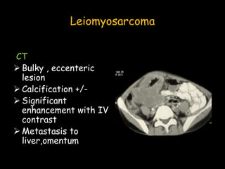 Leiomyosarcoma
CT
 Bulky , eccenteric
lesion
 Calcification +/-
 Significant
enhancement with IV
contrast
 Metastasis to
liver,omentum
 