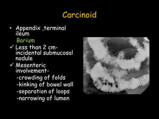 Carcinoid
• Appendix ,terminal
ileum
Barium
 Less than 2 cm-
incidental submucosal
nodule
 Mesenteric
involvement-
-crowding of folds
-kinking of bowel wall
-separation of loops
-narrowing of lumen
 