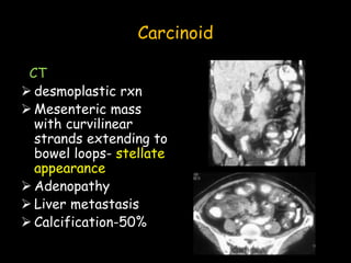 Carcinoid
CT
 desmoplastic rxn
 Mesenteric mass
with curvilinear
strands extending to
bowel loops- stellate
appearance
 Adenopathy
 Liver metastasis
 Calcification-50%
 