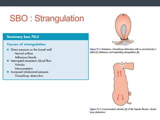 SBO : Strangulation
 