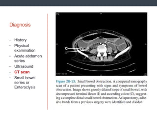 Diagnosis
• History
• Physical
examination
• Acute abdomen
series
• Ultrasound
• CT scan
• Small bowel
series or
Enteroclysis
 