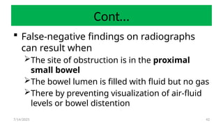 42
Cont…
 False-negative findings on radiographs
can result when
The site of obstruction is in the proximal
small bowel
The bowel lumen is filled with fluid but no gas
There by preventing visualization of air-fluid
levels or bowel distention
7/14/2025
 