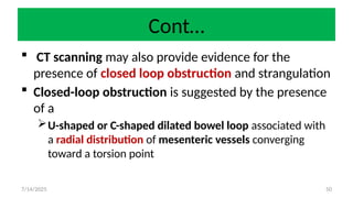 50
Cont…
 CT scanning may also provide evidence for the
presence of closed loop obstruction and strangulation
 Closed-loop obstruction is suggested by the presence
of a
U-shaped or C-shaped dilated bowel loop associated with
a radial distribution of mesenteric vessels converging
toward a torsion point
7/14/2025
 
