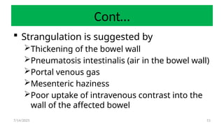 51
Cont…
 Strangulation is suggested by
Thickening of the bowel wall
Pneumatosis intestinalis (air in the bowel wall)
Portal venous gas
Mesenteric haziness
Poor uptake of intravenous contrast into the
wall of the affected bowel
7/14/2025
 