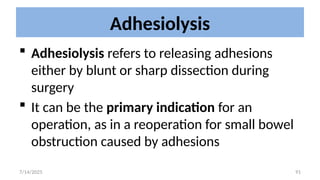 91
Adhesiolysis
 Adhesiolysis refers to releasing adhesions
either by blunt or sharp dissection during
surgery
 It can be the primary indication for an
operation, as in a reoperation for small bowel
obstruction caused by adhesions
7/14/2025
 