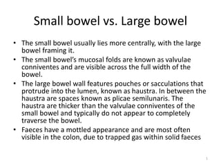 Small bowel vs. Large bowel
• The small bowel usually lies more centrally, with the large
bowel framing it.
• The small bowel’s mucosal folds are known as valvulae
conniventes and are visible across the full width of the
bowel.
• The large bowel wall features pouches or sacculations that
protrude into the lumen, known as haustra. In between the
haustra are spaces known as plicae semilunaris. The
haustra are thicker than the valvulae conniventes of the
small bowel and typically do not appear to completely
traverse the bowel.
• Faeces have a mottled appearance and are most often
visible in the colon, due to trapped gas within solid faeces
1
 