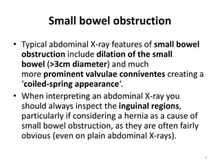 Valvulae Small bowel vs large.pptx