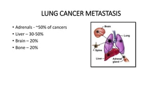 LUNG CANCER METASTASIS
• Adrenals - ~50% of cancers
• Liver – 30-50%
• Brain – 20%
• Bone – 20%
 