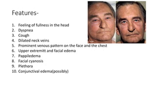 Features-
1. Feeling of fullness in the head
2. Dyspnea
3. Cough
4. Dilated neck veins
5. Prominent venous pattern on the face and the chest
6. Upper extremitt and facial edema
7. Pappiledema
8. Facial cyanosis
9. Plethora
10. Conjunctival edema(possibly)
 