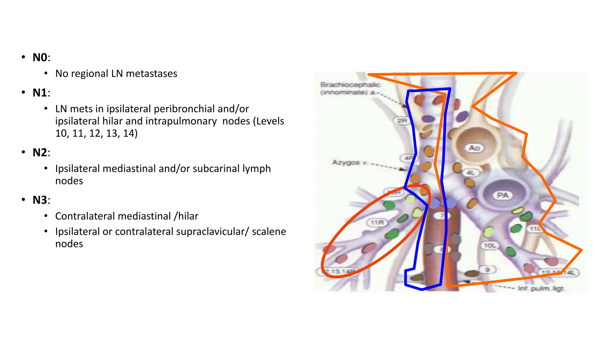 Small cell lung carcinoma anatomy to management | PPTX