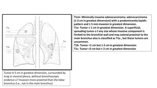 Small cell lung carcinoma anatomy to management | PPTX