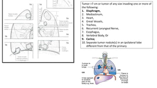 Small cell lung carcinoma anatomy to management | PPTX