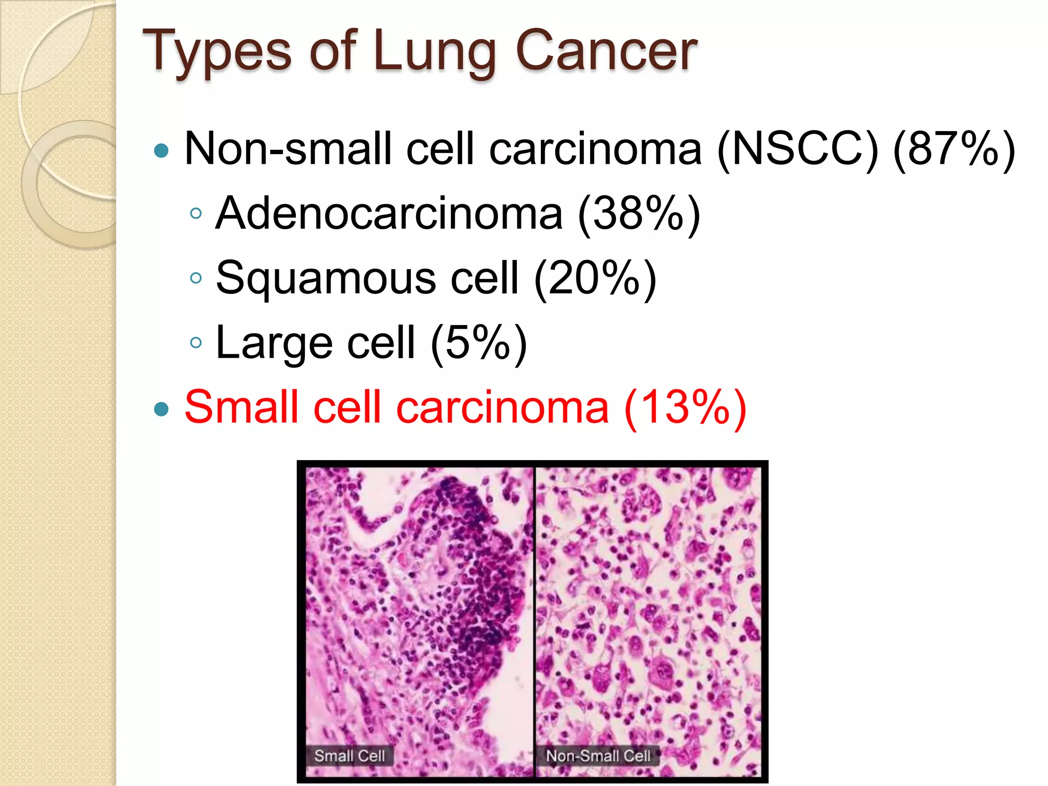 Small Cell Lung Cancer | PPTX