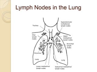 Lymph Nodes in the Lung
 