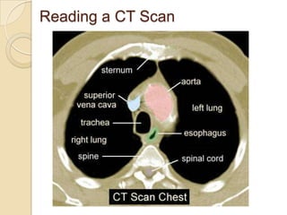 Reading a CT Scan
 