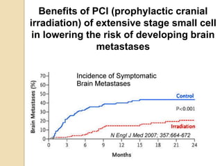 Benefits of PCI (prophylactic cranial
irradiation) of extensive stage small cell
in lowering the risk of developing brain
metastases
 