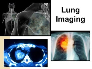 Lung Imaging Lung
Imaging
 