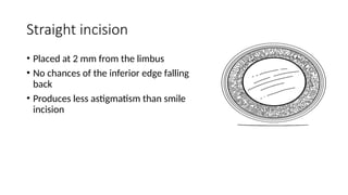 SMALL INCISION CATARACT SURGERY (SICS).pptx
