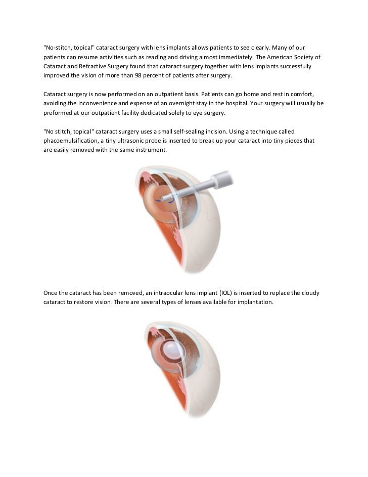 34 HOW COST OF CATARACT SURGERY IN INDIA PDF DOC
