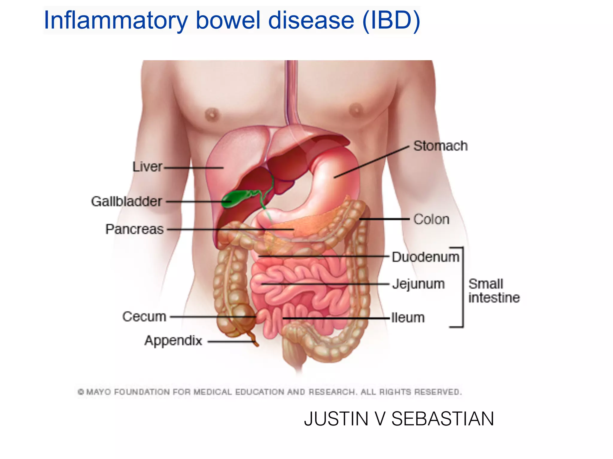 Small intestinal inflammation and infection | PPT