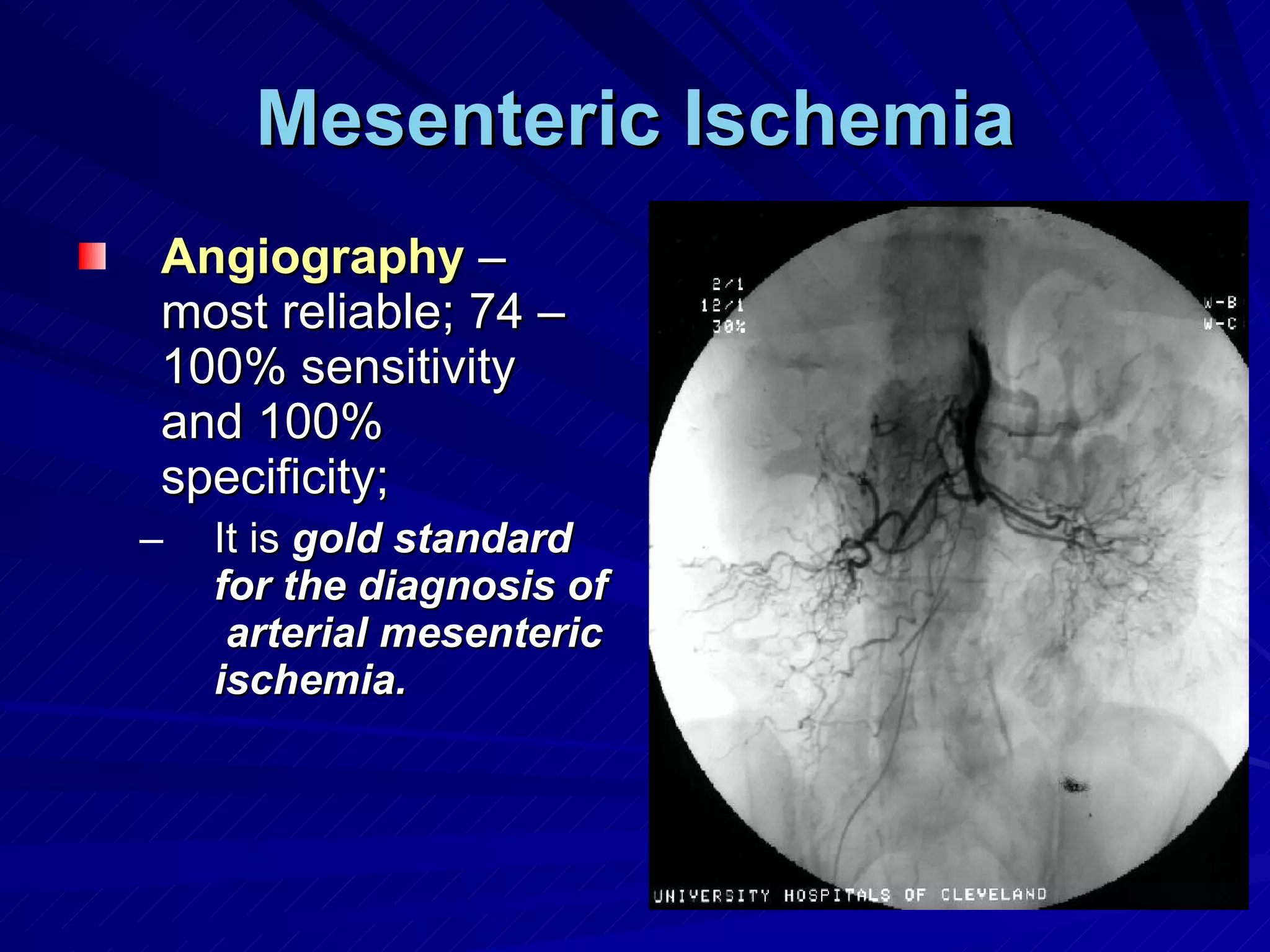 Mesenteric Ischemia Angiography   – most reliable; 74 – 100% sensitivity and 100% specificity;  It is  gold standard for the diagnosis of  arterial mesenteric ischemia.  