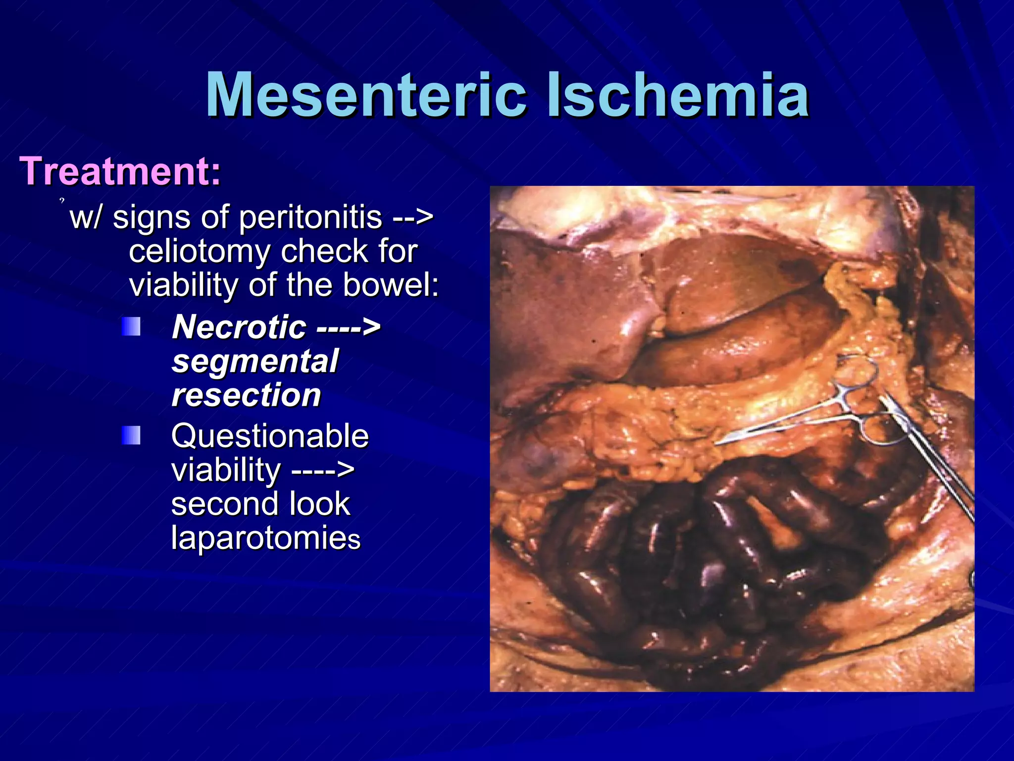 Mesenteric Ischemia Treatment: w/ signs of peritonitis --> celiotomy check for viability of the bowel: Necrotic ----> segmental resection Questionable viability ----> second look laparotomie s 